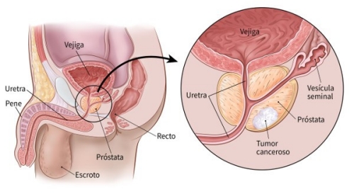 Suelo pélvico masculino