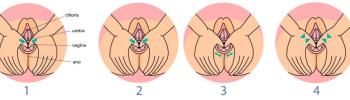 Masaje Perineal