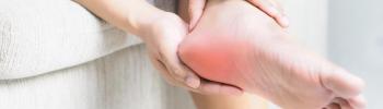 Ondas de Choque como tratamiento para la Fascitis Plantar - FisioClinics Bilbao