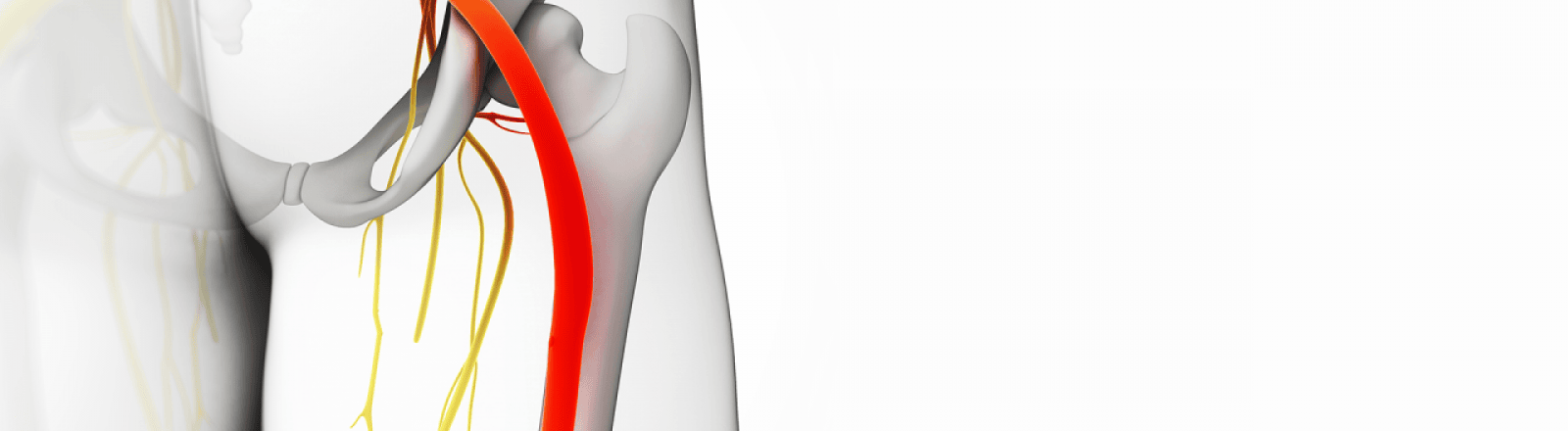 ciática y lumbociática ciática y lumbociática