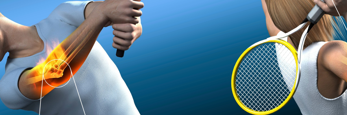 Factores emocionales y de la vida que influyen en la aparición de la epicondilitis