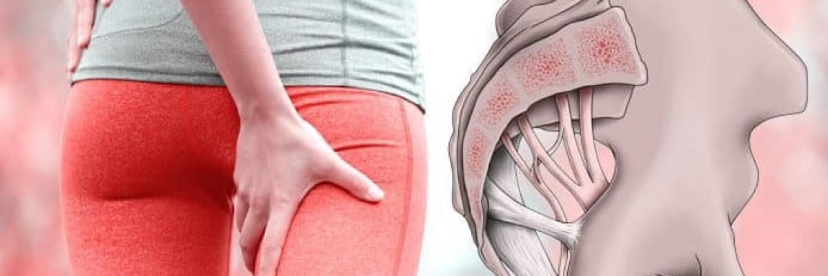 Neuralgia del nervio pudendo: tratamiento desde la fisioterapia del suelo pélvico