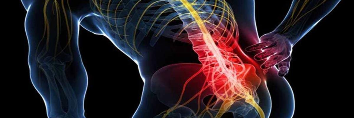 Ciática tratamiento mediante la fisioterapia - FisioClinics Bilbao