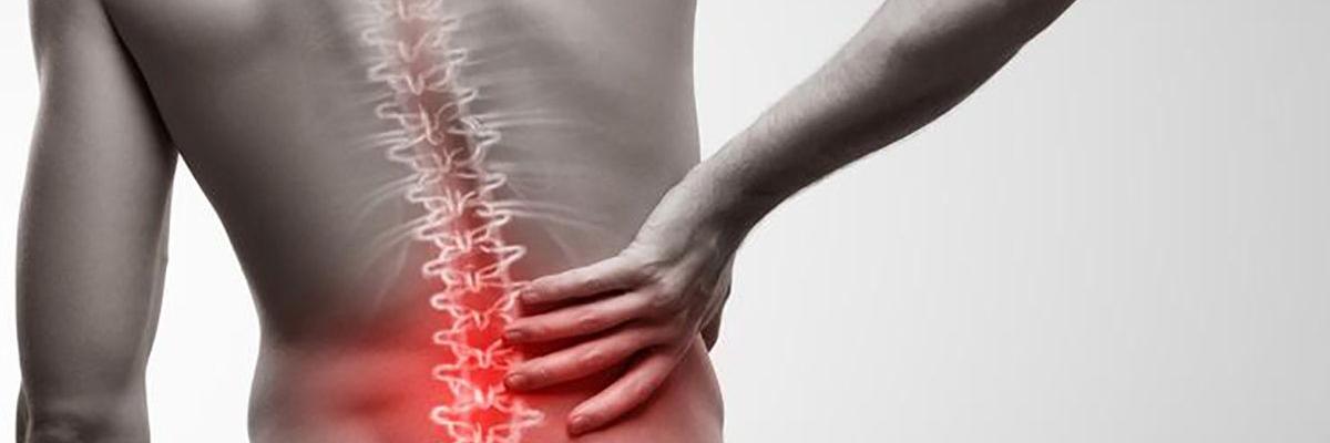 Sacroileítis, qué es, causas y tratamiento mediante fisioterapia