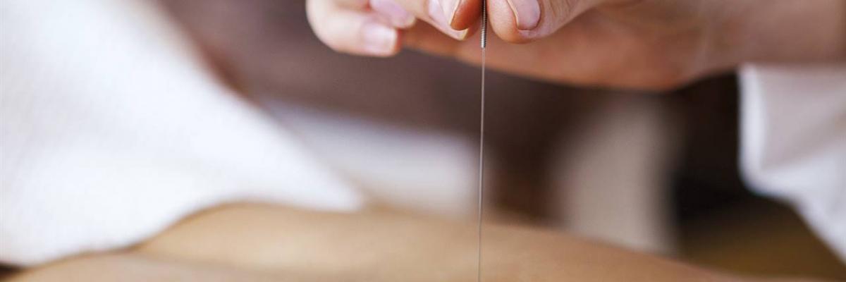 Punción seca y los puntos gatillo Bilbao