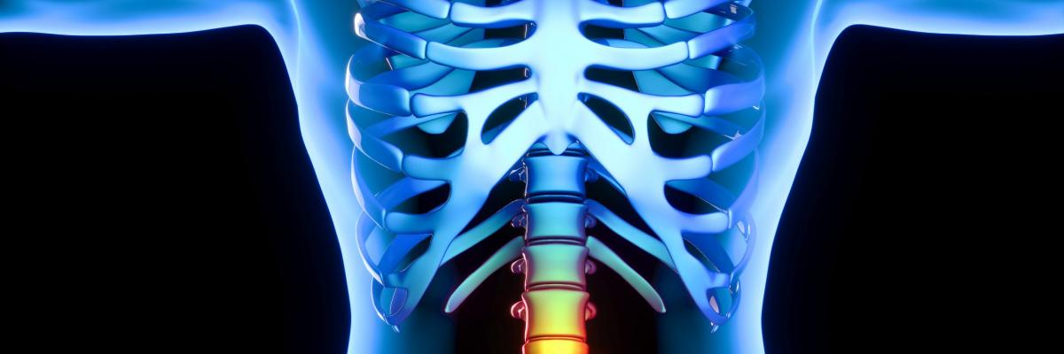 Estimulación eléctrica transcutánea (TENS) el tratamiento de la hernia discal lumbar