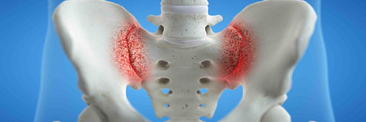 Aplicación de diatermia en el tratamiento de la sacroìleitis