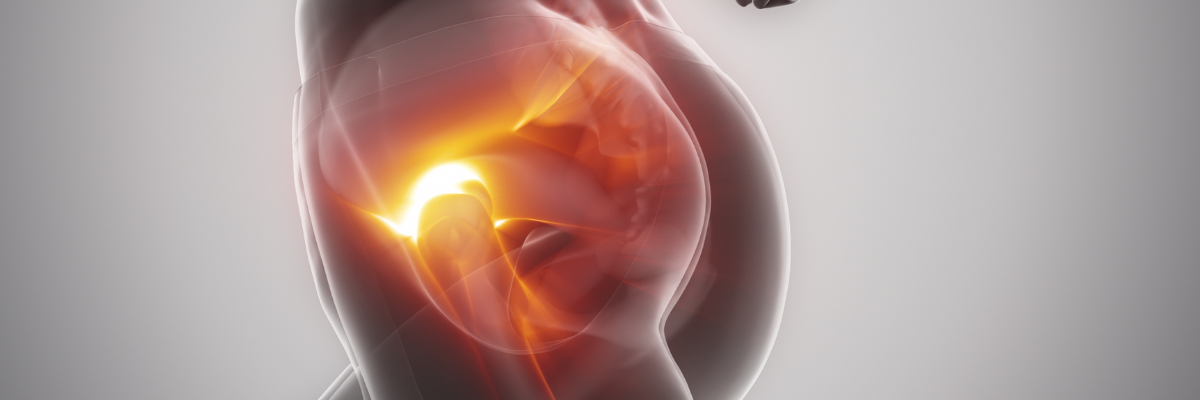 Qué emociones influyen en la aparición de la trocanteritis